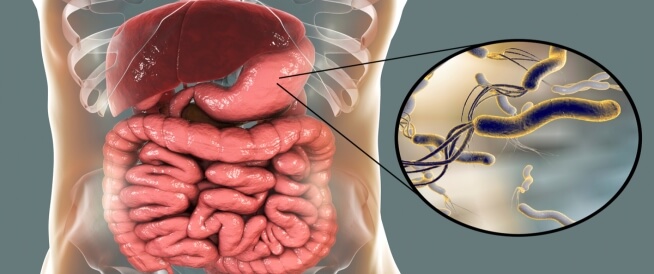 ما هي علاج جرثومة المعدة في الطب النبوي