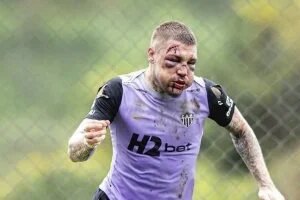 ليانكو يعود لمران أتلتيكو مينيرو بوجه بدون ملامح بعد خناقة الديربى.. صور