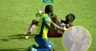 البرازيلي روماريو دا سيلفا يتعرض لإصابة خطيرة خلال مباراة في الدوري الهندوراسي
