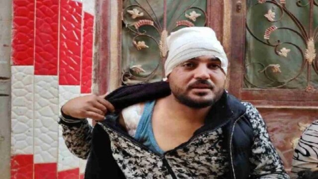 خلاف على أولوية المرور يؤدي لإصابة سائق بـ 112 غرزة على يد شخصين في الشرقية